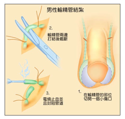 主要<em>避孕</em>方式,以及优缺点和<em>失败</em>率