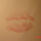 kiss