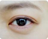 eye