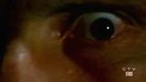 3x20eye